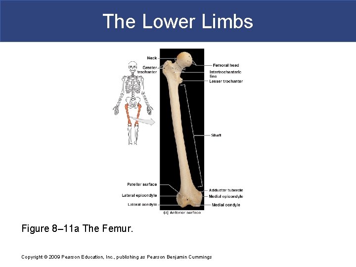 The Lower Limbs Figure 8– 11 a The Femur. Copyright © 2009 Pearson Education,