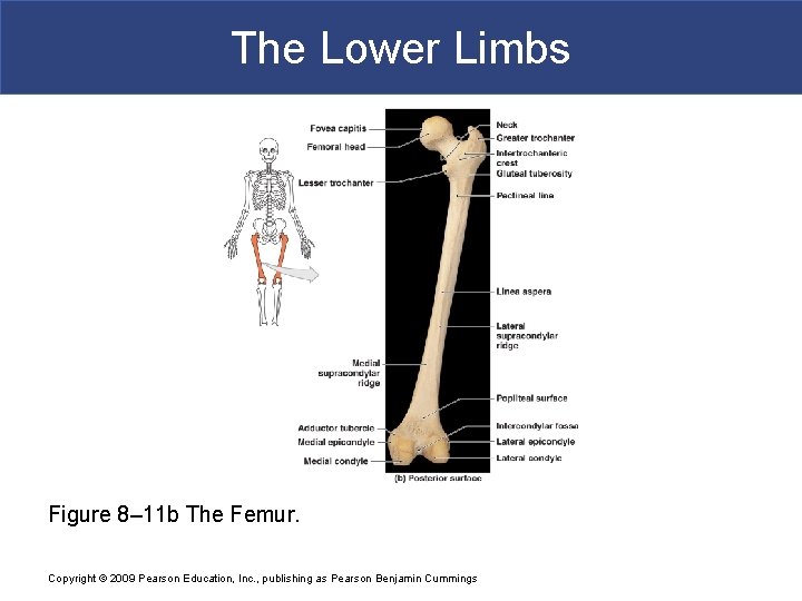 The Lower Limbs Figure 8– 11 b The Femur. Copyright © 2009 Pearson Education,