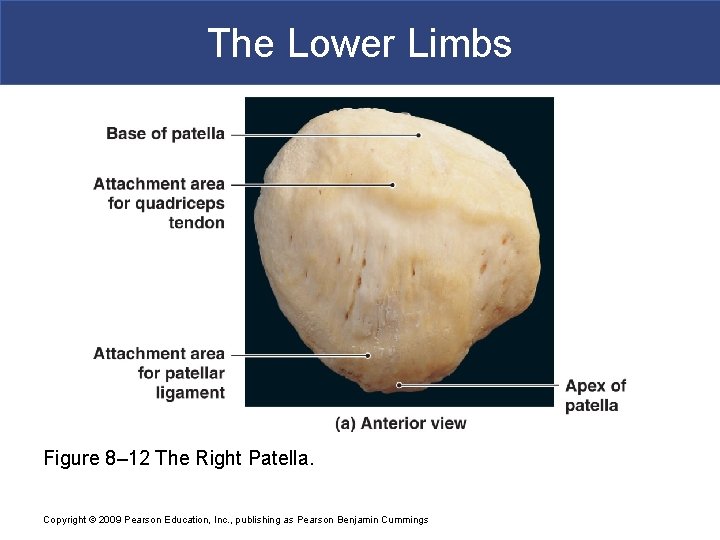 The Lower Limbs Figure 8– 12 The Right Patella. Copyright © 2009 Pearson Education,