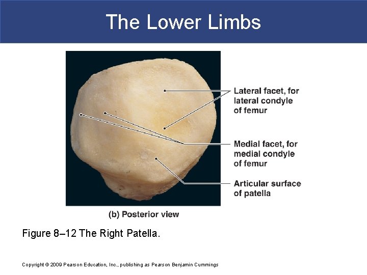 The Lower Limbs Figure 8– 12 The Right Patella. Copyright © 2009 Pearson Education,