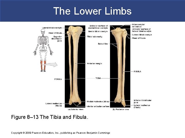 The Lower Limbs Figure 8– 13 The Tibia and Fibula. Copyright © 2009 Pearson