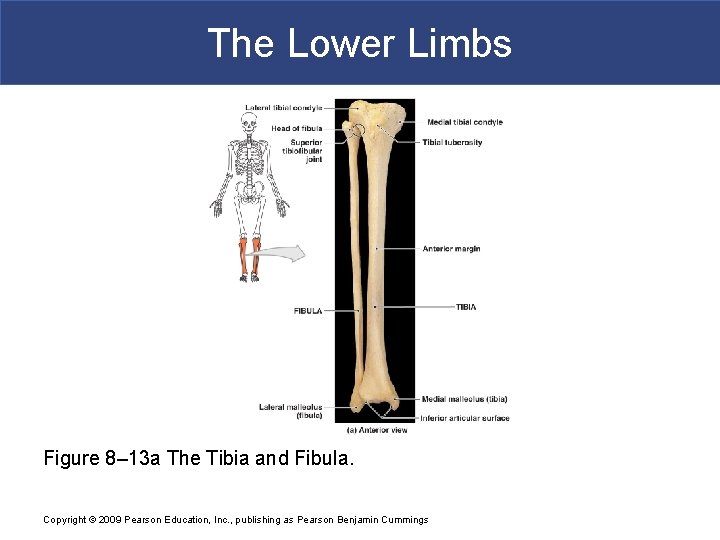 The Lower Limbs Figure 8– 13 a The Tibia and Fibula. Copyright © 2009