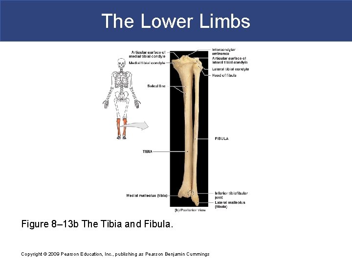 The Lower Limbs Figure 8– 13 b The Tibia and Fibula. Copyright © 2009