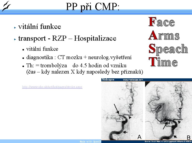 PP při CMP: vitální funkce transport - RZP – Hospitalizace vitální funkce diagnostika :