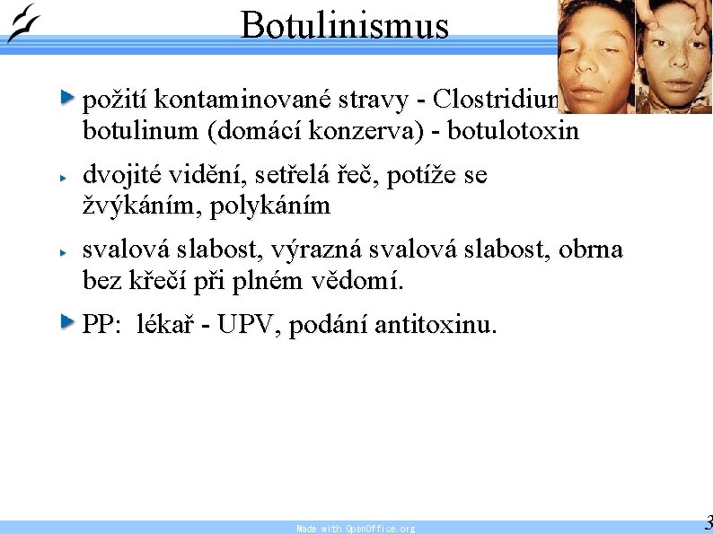Botulinismus požití kontaminované stravy - Clostridium botulinum (domácí konzerva) - botulotoxin dvojité vidění, setřelá