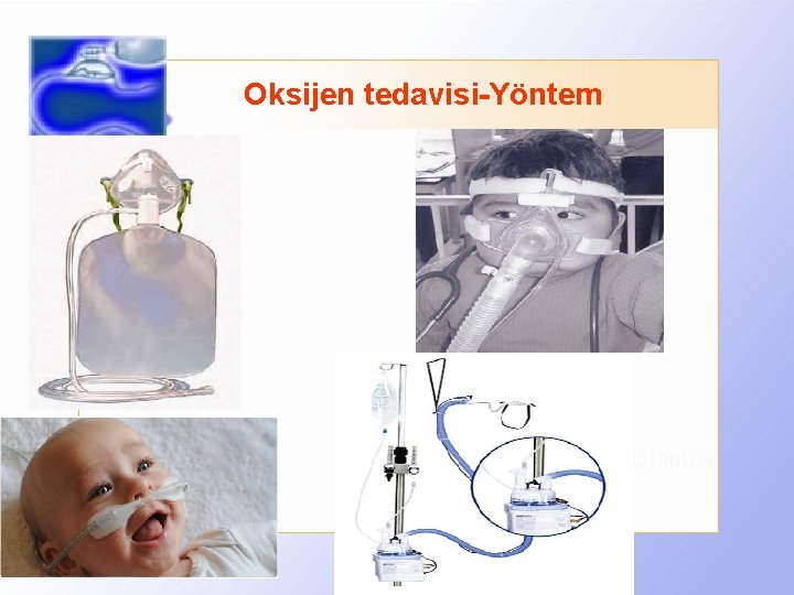 Oksijen tedavisi-Yöntem Oksijen bağlantısı Maske 