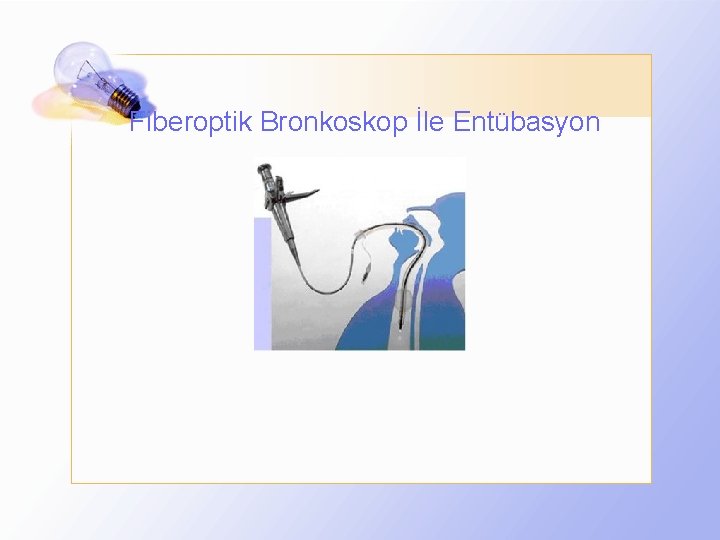 Fiberoptik Bronkoskop İle Entübasyon 