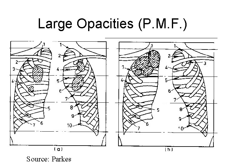 Large Opacities (P. M. F. ) Source: Parkes 