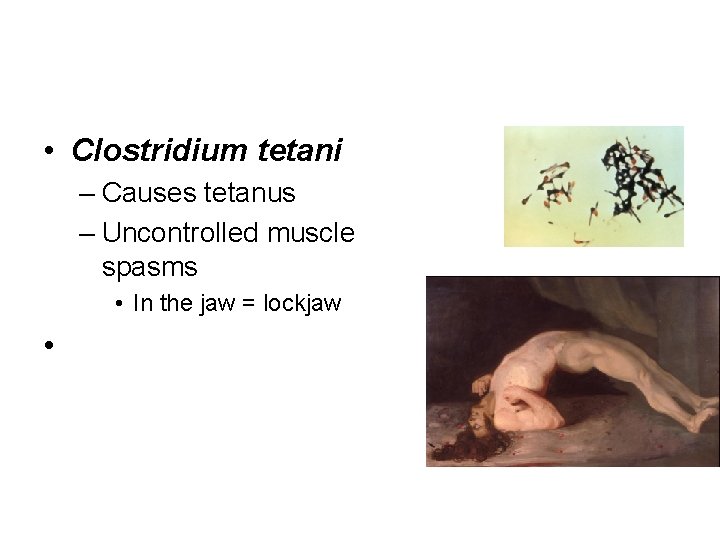  • Clostridium tetani – Causes tetanus – Uncontrolled muscle spasms • In the