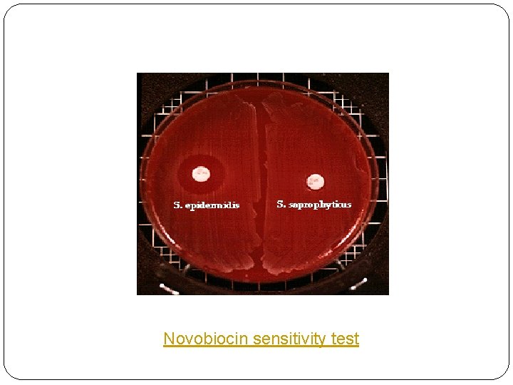 Novobiocin sensitivity test 