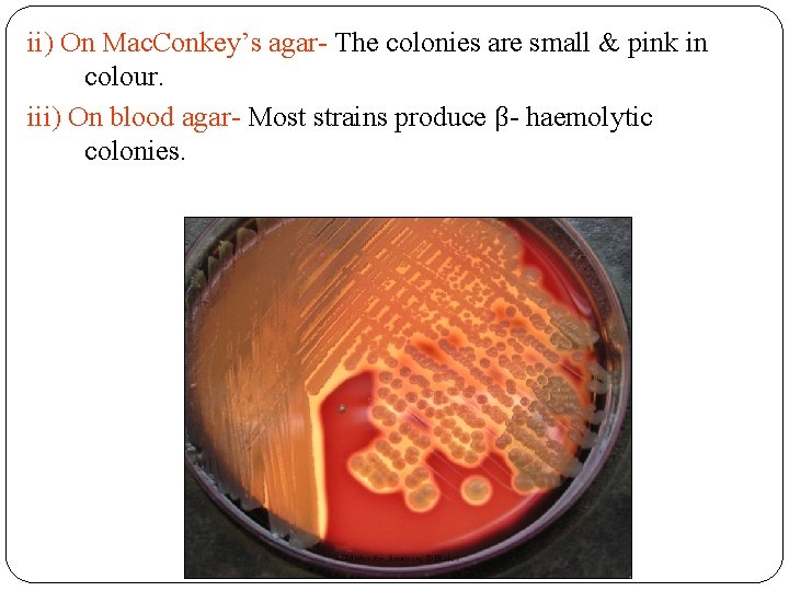 ii) On Mac. Conkey’s agar- The colonies are small & pink in colour. iii)