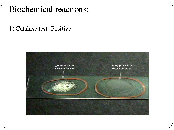 Biochemical reactions: 1) Catalase test- Positive. 