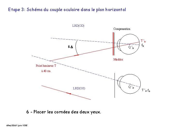 Etape 3: Schéma du couple oculaire dans le plan horizontal LRD(OD) Compensation 8 D