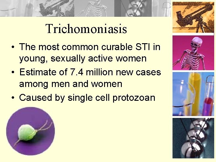 Trichomoniasis • The most common curable STI in young, sexually active women • Estimate