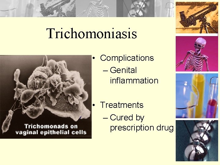 Trichomoniasis • Complications – Genital inflammation • Treatments – Cured by prescription drug 