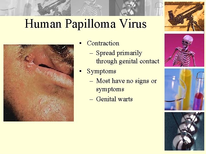 Human Papilloma Virus • Contraction – Spread primarily through genital contact • Symptoms –