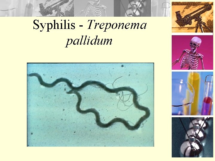 Syphilis - Treponema pallidum 