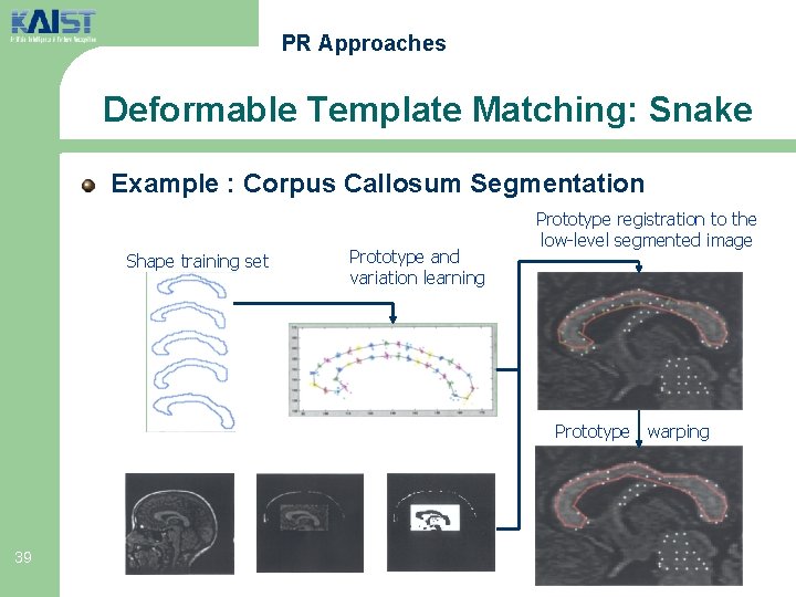 PR Approaches Deformable Template Matching: Snake Example : Corpus Callosum Segmentation Shape training set