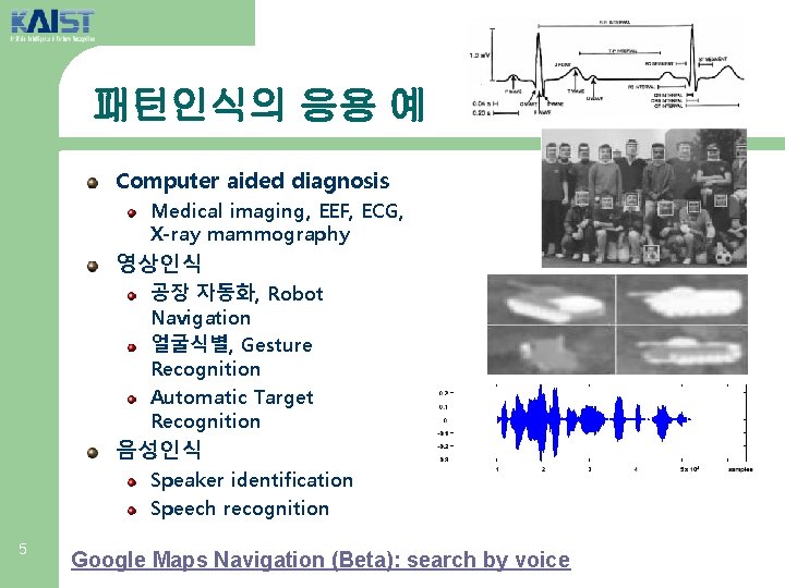 패턴인식의 응용 예 Computer aided diagnosis Medical imaging, EEF, ECG, X-ray mammography 영상인식 공장