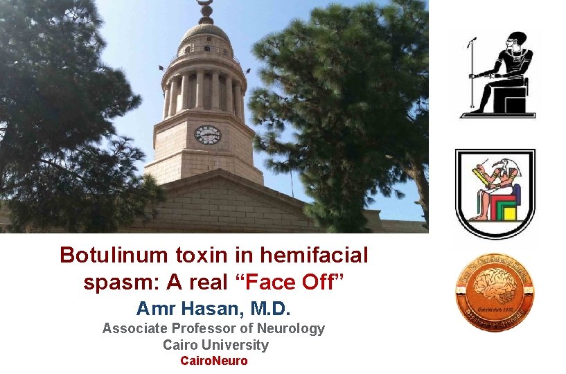 Botulinum toxin in hemifacial spasm: A real “Face Off” Amr Hasan, M. D. Associate