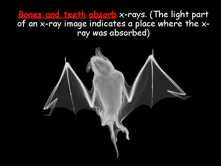 Bones and teeth absorb x-rays. (The light part of an x-ray image indicates a