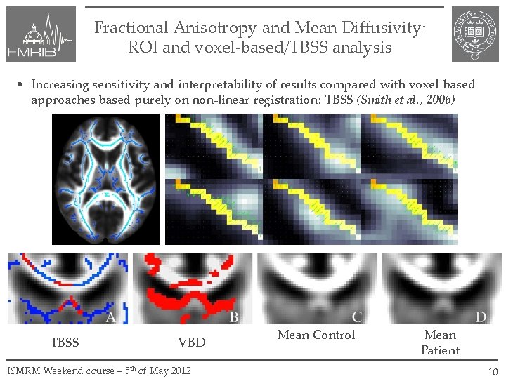 Fractional Anisotropy and Mean Diffusivity: ROI and voxel-based/TBSS analysis • Increasing sensitivity and interpretability