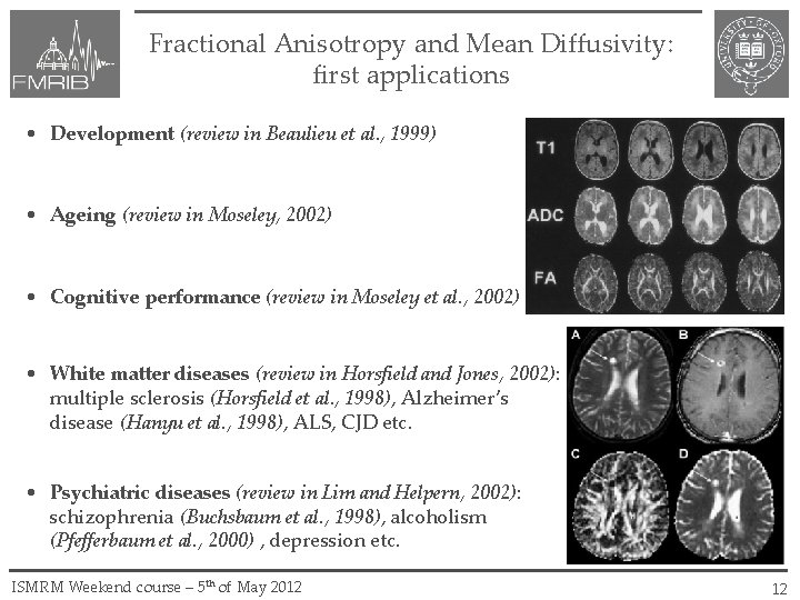 Fractional Anisotropy and Mean Diffusivity: first applications • Development (review in Beaulieu et al.