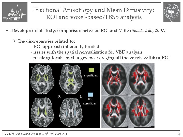 Fractional Anisotropy and Mean Diffusivity: ROI and voxel-based/TBSS analysis • Developmental study: comparison between