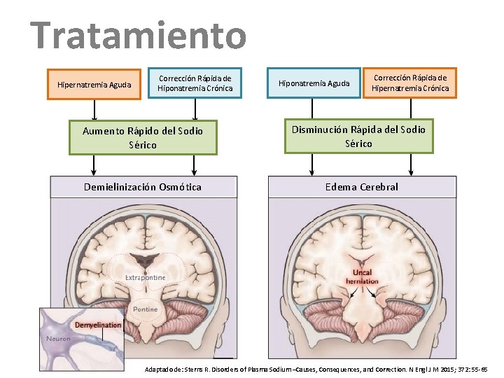 Tratamiento Hipernatremia Aguda Corrección Rápida de Hiponatremia Crónica Hiponatremia Aguda Corrección Rápida de Hipernatremia