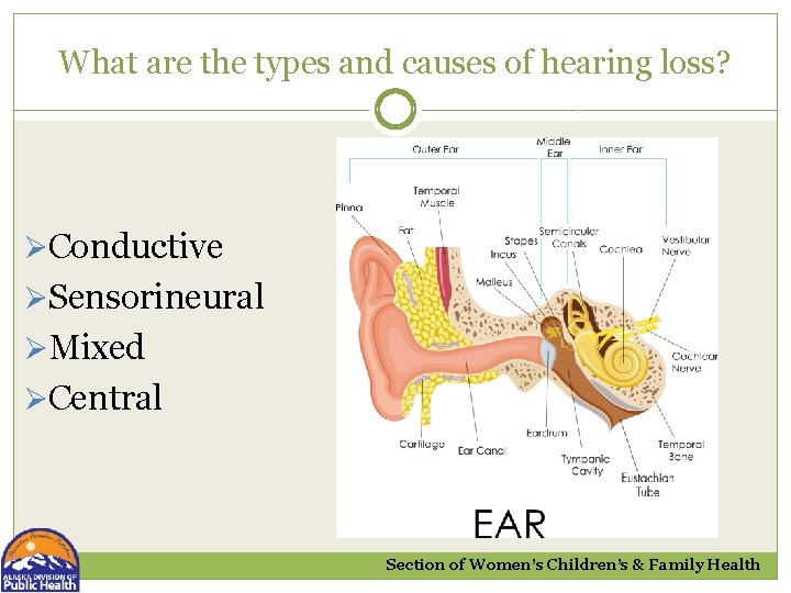 What are the types and causes of hearing loss? ØConductive ØSensorineural ØMixed ØCentral Section