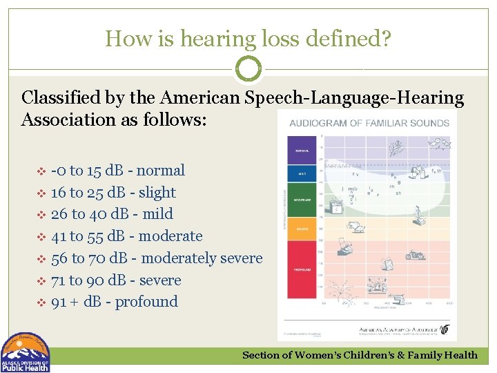 How is hearing loss defined? Classified by the American Speech-Language-Hearing Association as follows: v