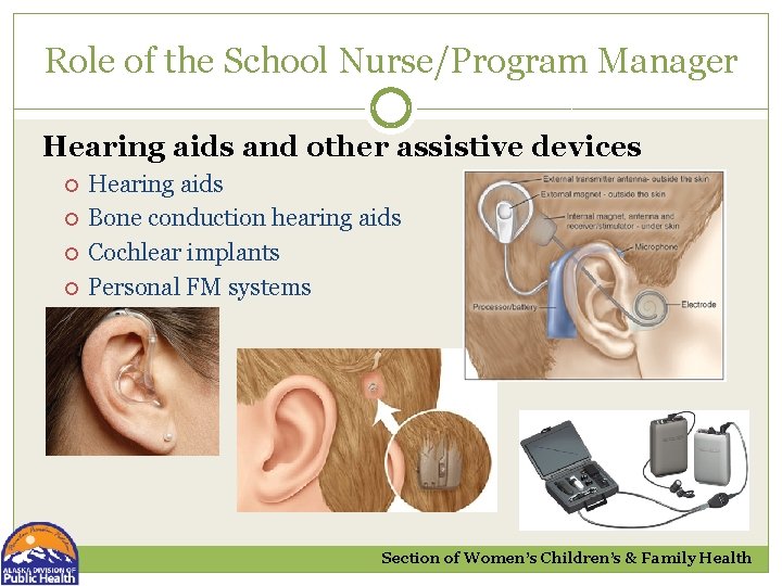 Role of the School Nurse/Program Manager Hearing aids and other assistive devices Hearing aids