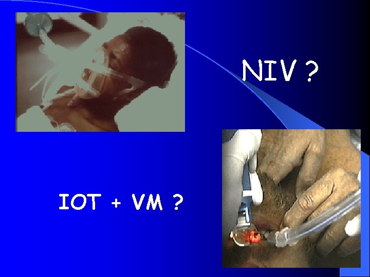 NIV ? IOT + VM ? 