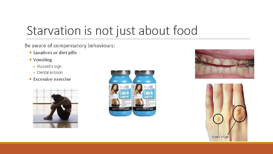Starvation is not just about food Be aware of compensatory behaviours: • Laxatives or Starvation is not just about food Be aware of compensatory behaviours: • Laxatives or