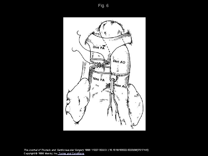 Fig. 6 The Journal of Thoracic and Cardiovascular Surgery 1996 11227 -32 DOI: (10.