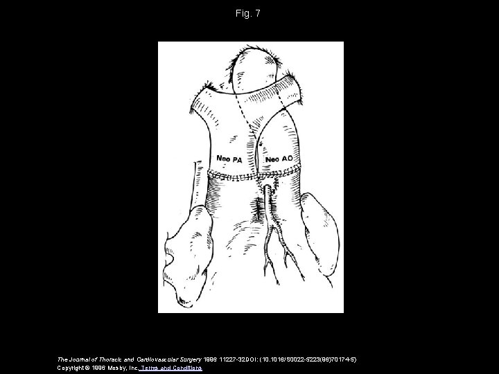 Fig. 7 The Journal of Thoracic and Cardiovascular Surgery 1996 11227 -32 DOI: (10.