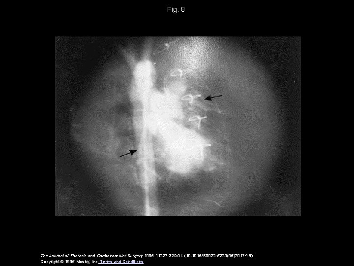 Fig. 8 The Journal of Thoracic and Cardiovascular Surgery 1996 11227 -32 DOI: (10.