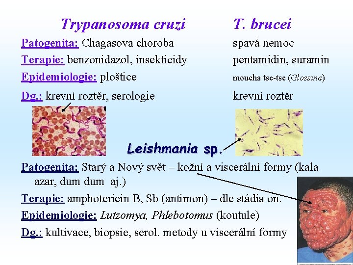 Trypanosoma cruzi T. brucei Patogenita: Chagasova choroba Terapie: benzonidazol, insekticidy Epidemiologie: ploštice spavá nemoc Trypanosoma cruzi T. brucei Patogenita: Chagasova choroba Terapie: benzonidazol, insekticidy Epidemiologie: ploštice spavá nemoc