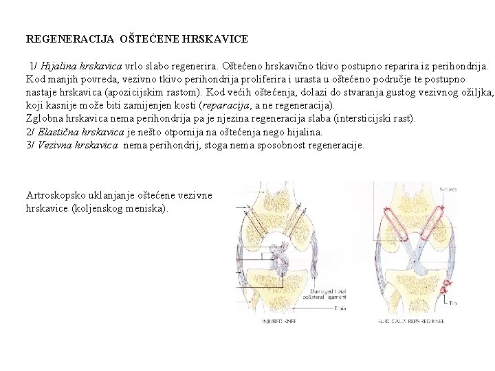 REGENERACIJA OŠTEĆENE HRSKAVICE 1/ Hijalina hrskavica vrlo slabo regenerira. Oštećeno hrskavično tkivo postupno reparira
