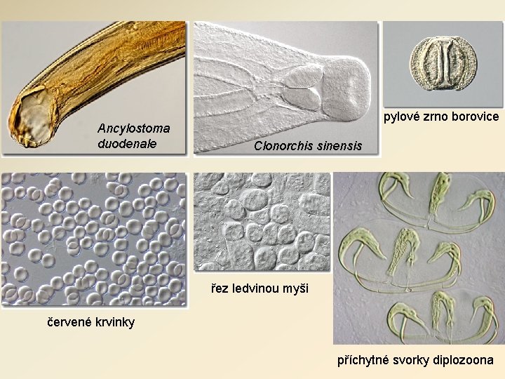 Ancylostoma duodenale pylové zrno borovice Clonorchis sinensis řez ledvinou myši červené krvinky příchytné svorky Ancylostoma duodenale pylové zrno borovice Clonorchis sinensis řez ledvinou myši červené krvinky příchytné svorky