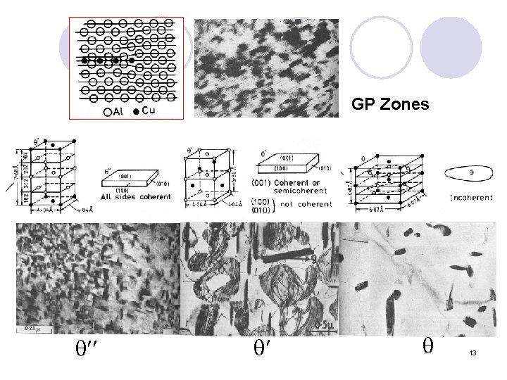 GP Zones 13 