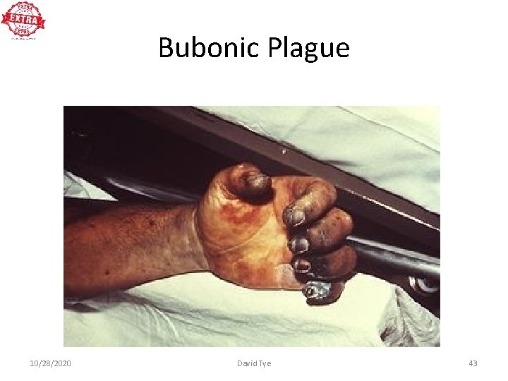 Bubonic Plague 10/28/2020 David Tye 43 