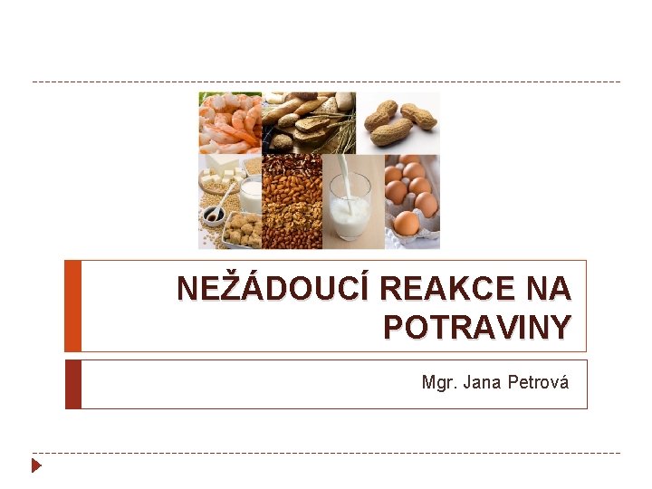 NEŽÁDOUCÍ REAKCE NA POTRAVINY Mgr. Jana Petrová 