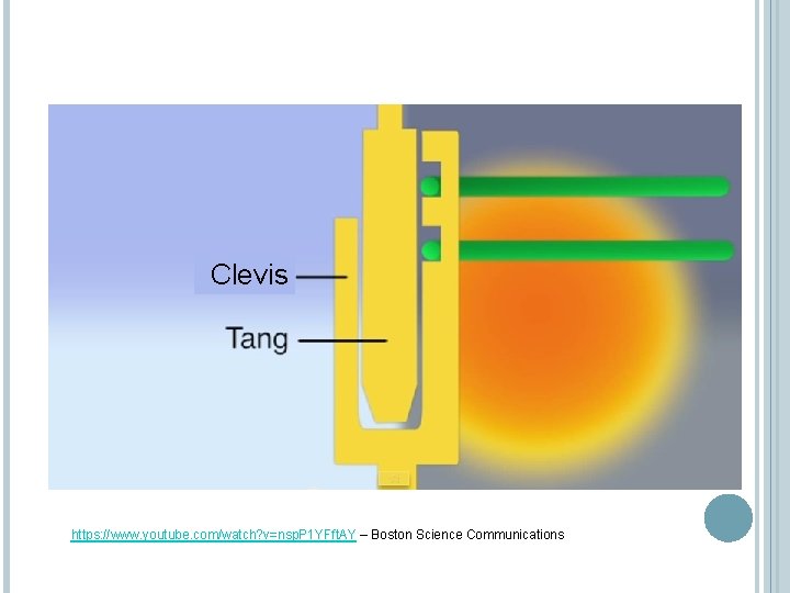 Clevis https: //www. youtube. com/watch? v=nsp. P 1 YFft. AY – Boston Science Communications Clevis https: //www. youtube. com/watch? v=nsp. P 1 YFft. AY – Boston Science Communications