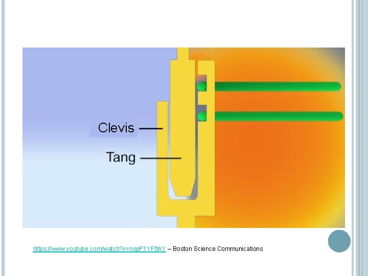 Clevis https: //www. youtube. com/watch? v=nsp. P 1 YFft. AY – Boston Science Communications Clevis https: //www. youtube. com/watch? v=nsp. P 1 YFft. AY – Boston Science Communications