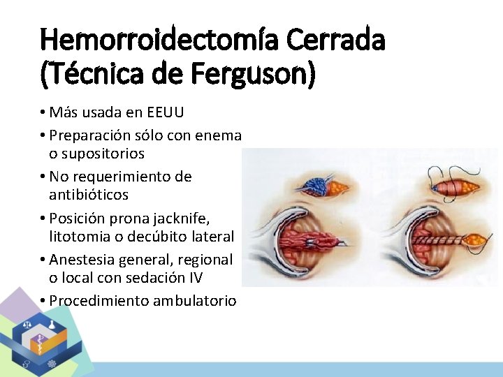 Hemorroidectomía Cerrada (Técnica de Ferguson) • Más usada en EEUU • Preparación sólo con