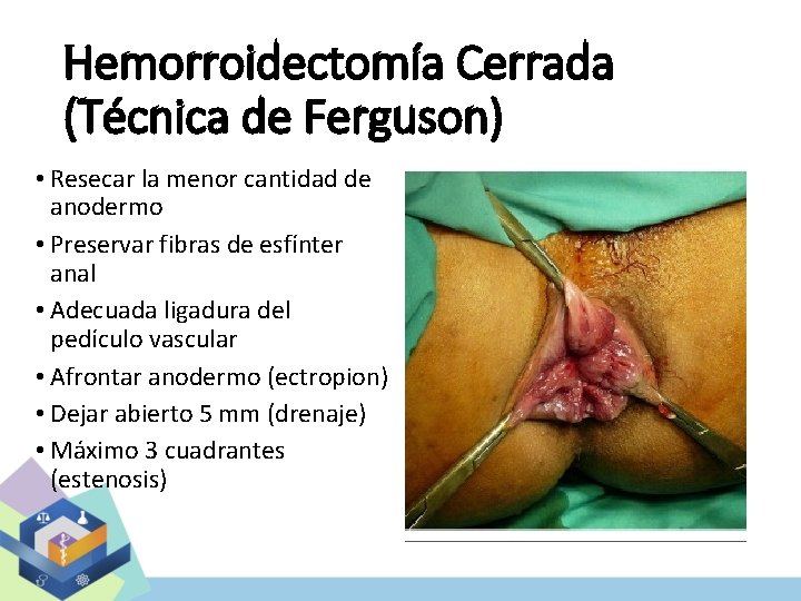 Hemorroidectomía Cerrada (Técnica de Ferguson) • Resecar la menor cantidad de anodermo • Preservar