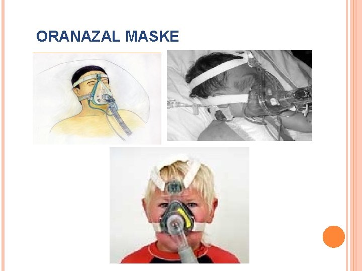 ORANAZAL MASKE 