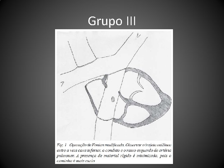 Grupo III 