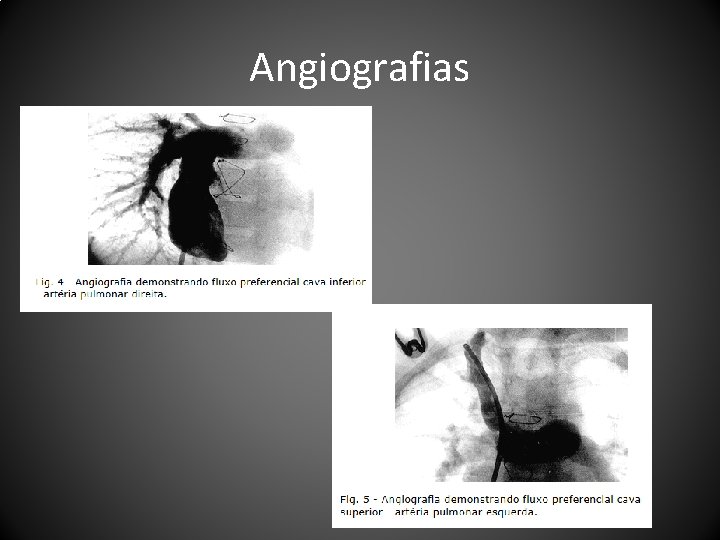 Angiografias 